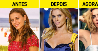 14 Celebridades que deixaram os retoques estéticos no passado