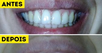 Experimentamos 5 formas caseiras de clarear os dentes (o bicarbonato de sódio nos decepcionou)
