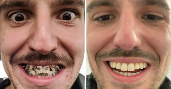 18 Provas de que uma pessoa pode ficar ainda melhor com um sorriso perfeito