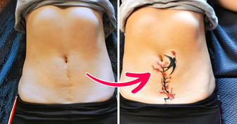 16 Tatuagens que não esconderam cicatrizes, fizeram delas o detalhe mais marcante