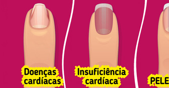 Seu corpo pode estar pedindo socorro e as unhas dão o primeiro sinal