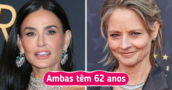 17 Comparações entre famosas para mostrar os efeitos dos procedimentos estéticos