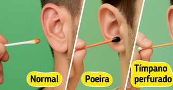5 Cores de cera de ouvido que podem indicar um problema de saúde oculto