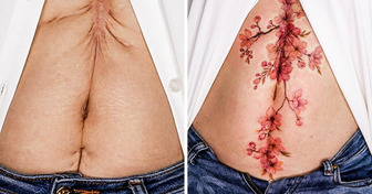 20+ Pessoas que escolheram tatuagens para ressignificar suas cicatrizes