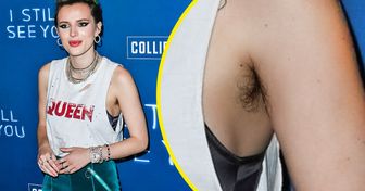 13 Celebridades que aceitaram e têm orgulho dos seus pelos corporais