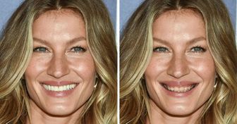 Como seriam estas 18 celebridades caso seus dentes não fossem “perfeitos”