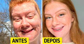 16 Pessoas que esbanjaram orgulho ao mostrar como mudaram ao longo dos anos