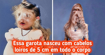 15 Pessoas que nasceram com traços exclusivos dados pela Mãe Natureza