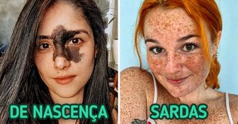 15 Pessoas que encantaram o mundo com sua beleza autêntica