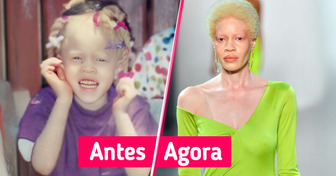 Alvo de bullying por albinismo, ela virou estrela nas passarelas do mundo