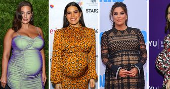 30 Looks das futuras mamães famosas mostrando como arrasar no estilo durante a gravidez