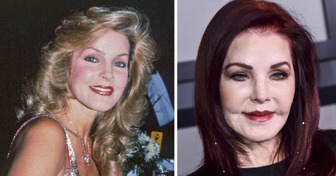 13 Famosos que mudaram radicalmente depois de se renderem à cirurgia plástica