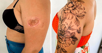 Cicatriz vira traço e dor se torna manifesto nas mãos de uma tatuadora brasileira