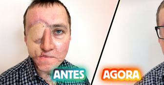 Tatuadora transforma cicatriz em arte com tatuagem hiper-realista no olho de sobrevivente de acidente