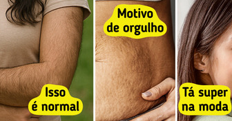 11 Traços que fazem parte da beleza feminina e não precisam ser corrigidos