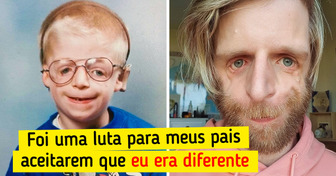 A história do britânico que superou a rejeição dos pais e hoje ajuda pessoas que passam por situações parecidas