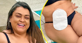 7 Celebridades brasileiras que desafiam padrões ao exibir seu corpo real