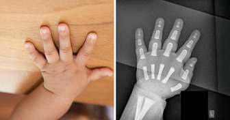 20 Raios X e ressonâncias tão inusitadas que nem os mais céticos vão ficar indiferentes