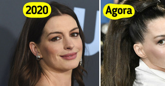 Anne Hathaway surge irreconhecível em novas fotos e divide opiniões