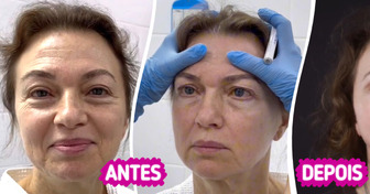 “Ela parece ter 30!” Mulher de 58 anos foi submetida a uma plástica facial e deixou muita gente chocada