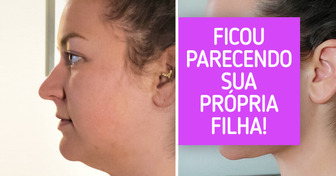 16 Corajosos decidiram pela cirurgia plástica e nunca foram tão felizes