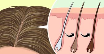 Os fios grisalhos podem ser reversíveis e aqui está o que você pode fazer para restituir a cor original ao seu cabelo