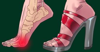Uso de salto alto não prejudica só seus pés: outras 3 partes do corpo também sofrem com eles