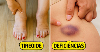 16 Sinais de alerta — O que seu corpo está tentando te mostrar