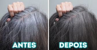 10 Soluções que podem tratar e prevenir o aparecimento dos cabelos grisalhos