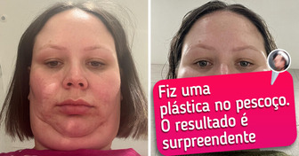 18 Fotos de “antes de depois” que mostram que tudo é possível quando se tem vontade