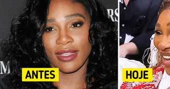 Serena Williams aparece com novo visual e reacende debate sobre exagero no uso de botox