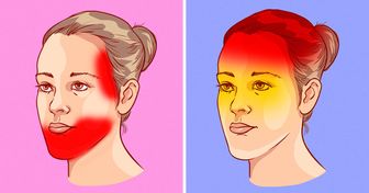 9 Tipos de dor de cabeça que podem ter origem em problemas de saúde
