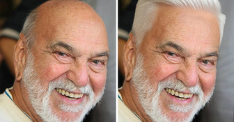 Como seriam 18 famosos se a calvície nunca tivesse chegado