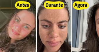 Mulher para de lavar o rosto, abandona skincare e surpreende com a transformação