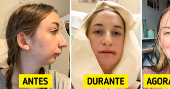 Jovem revela o resultado da sua cirurgia na mandíbula e encanta internautas