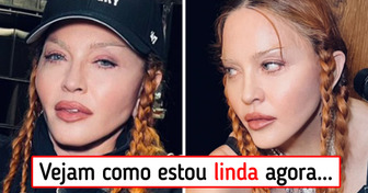 Madonna publica foto para cutucar quem criticou sua aparência