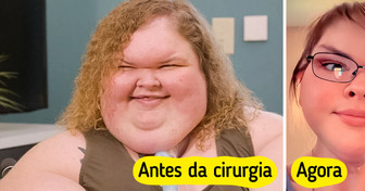 “Que orgulho!”, a transformação da estrela de reality após remoção de pele