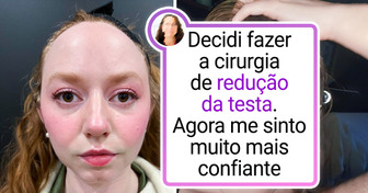 20+ Fotos que mostram claramente o que é uma “grande diferença”
