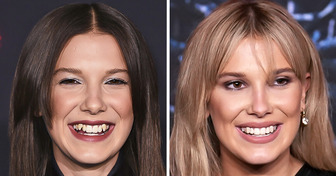 15+ Celebridades que investiram no sorriso e não se arrependeram