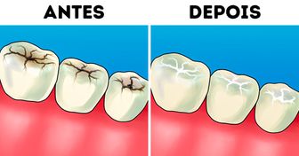 Dentista dá 8 respostas às perguntas mais comuns sobre cuidados com os dentes