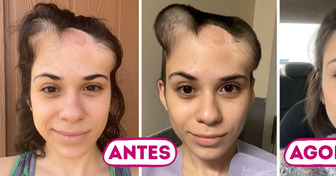 13 Pessoas que abraçaram seu novo eu com coragem após transformações milagrosas