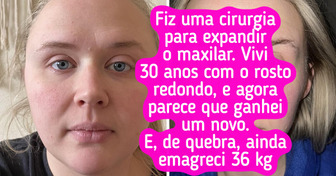 15 Mulheres que transformaram seus rostos e vidas — e não escondem a felicidade