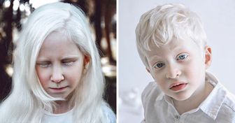 Fotógrafa captura imagens de pessoas com albinismo para mostrar sua beleza formidável e única