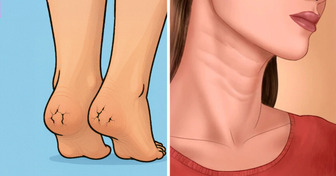 8 Pistas na pele de que seu corpo está tentando avisar que algo vai mal
