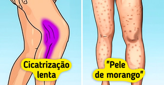 7 Jeitos nem sempre discretos de o seu corpo pedir por mais colágeno
