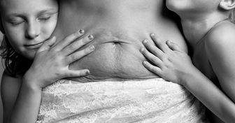 Série fotográfica mostra o corpo real das mulheres após a gravidez