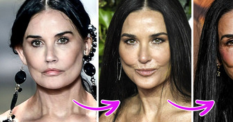 Especialistas explicam o mistério do que pode ter acontecido com o rosto de Demi Moore