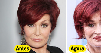 “Fui longe demais”, Sharon Osbourne finalmente revela a verdade sobre sua transformação estética
