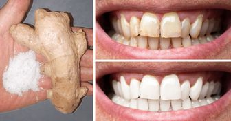 8 Maneiras naturais de deixar seus dentes mais brancos em casa