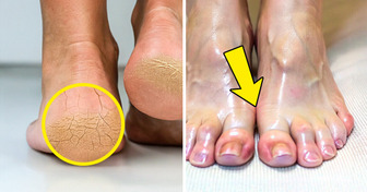 7 Cuidados de beleza para os pés que talvez você nunca tenha pensado em experimentar